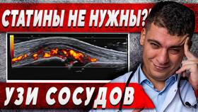 Сосуды забиты на 90 процентов: что делать в Emex